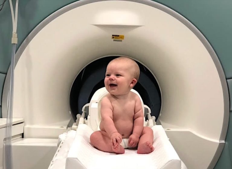 The Brains Of Newborns - NeuroLogica Blog