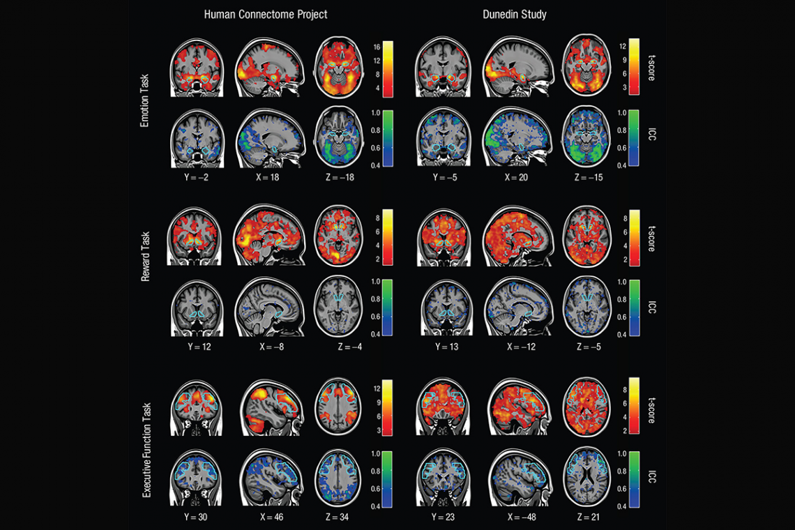 FMRI Researcher Questions FMRI Research - NeuroLogica Blog